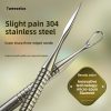 Professional Stainless Steel Acne Extraction Needle